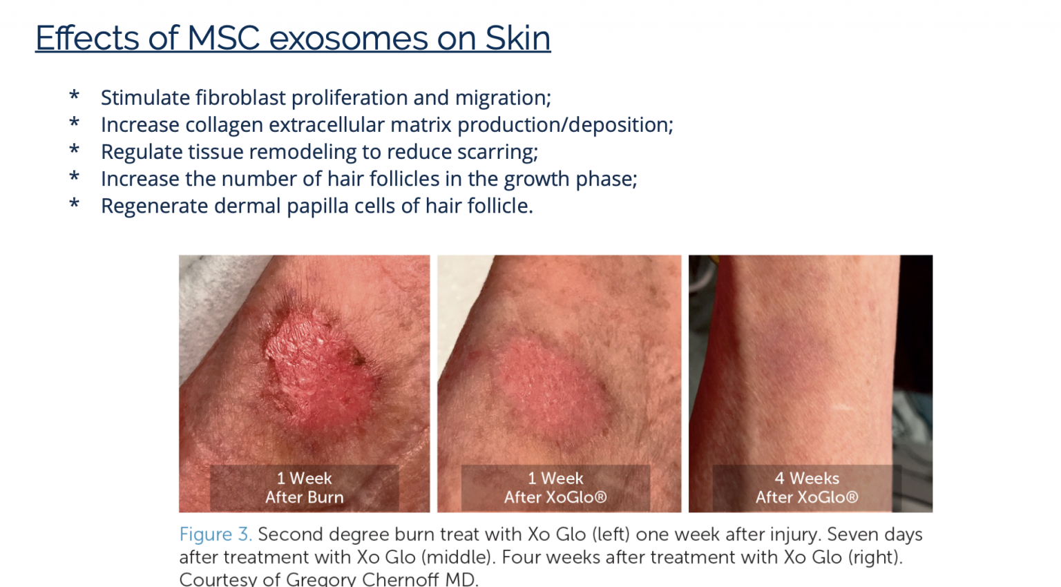 Exosomes – iSpa Consulting Inc.