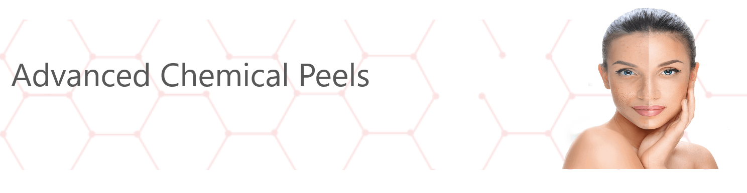 advanced chemical peels for medspa